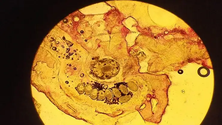 Dikkat! Temas ile bulaşıyor
