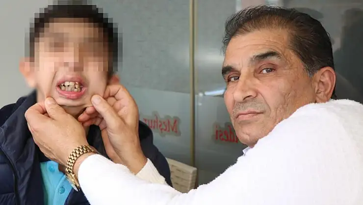 Alt çenesi yok, dişleri üst damağında