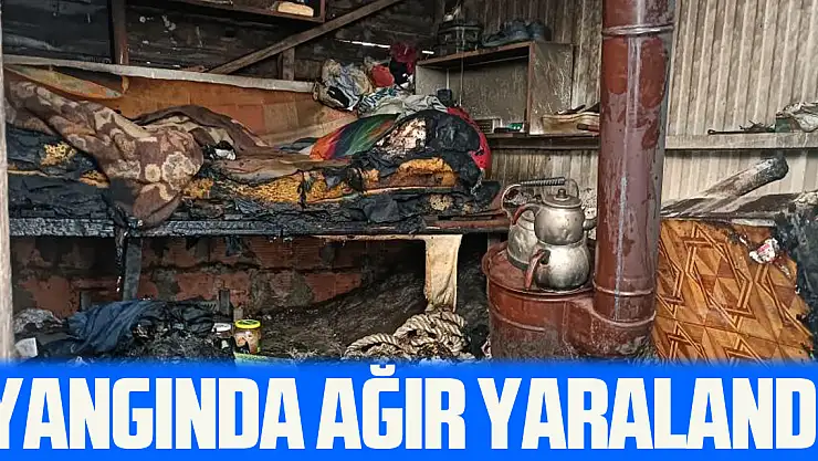 YANGINDA AĞIR YARALANDI