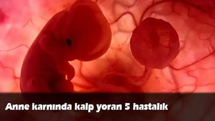 Anne karnında kalp yoran 5 hastalık
