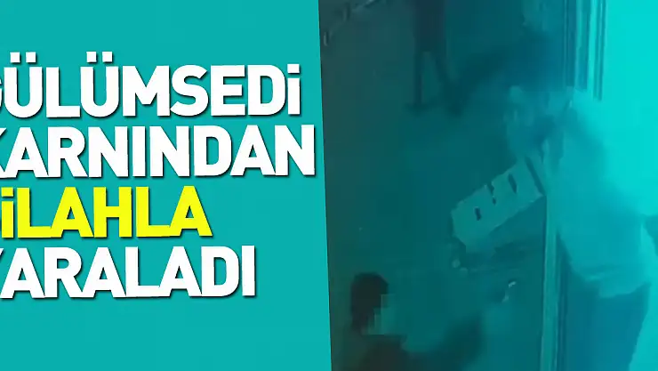 Gülümsedi karnından yaraladı