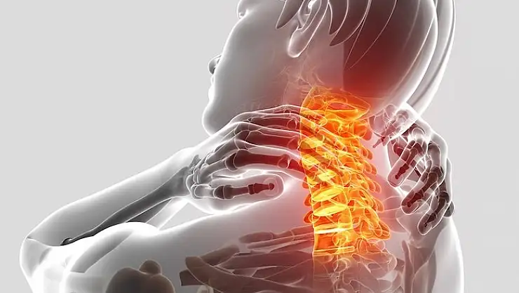 Boyun fıtığında ameliyatsız tedavi