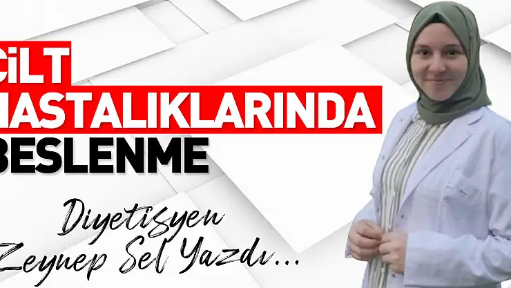 CİLT HASTALIKLARINDA BESLENME