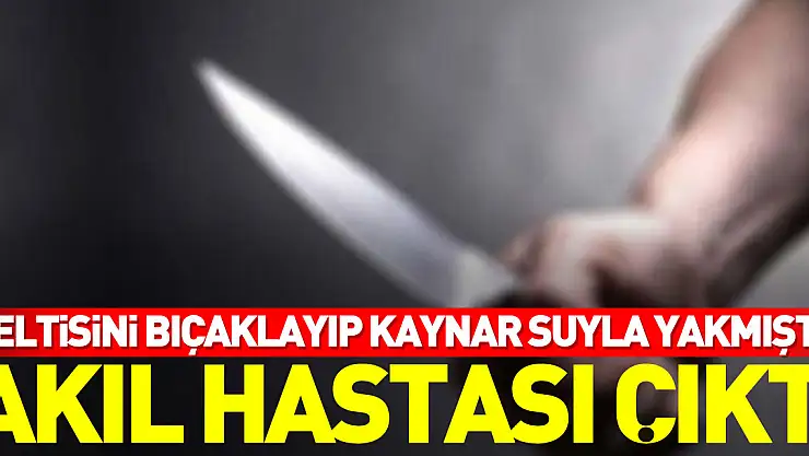 Eltisini bıçaklayıp kaynar suyla yakmıştı, akıl hastası çıktı