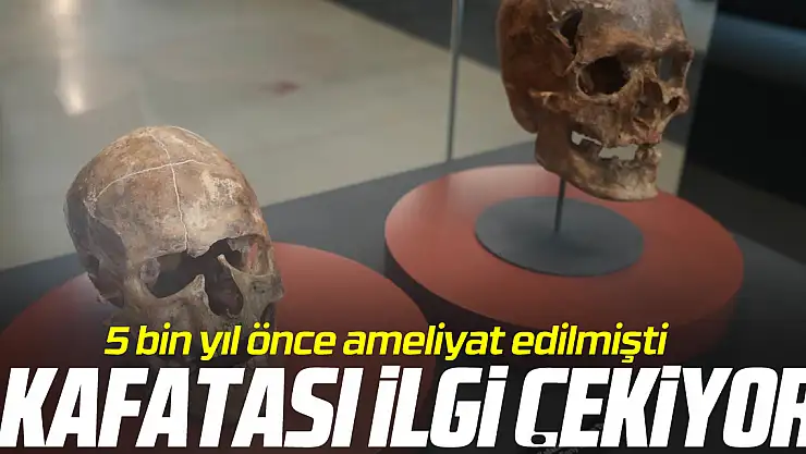 Kafatası ilgi çekiyor