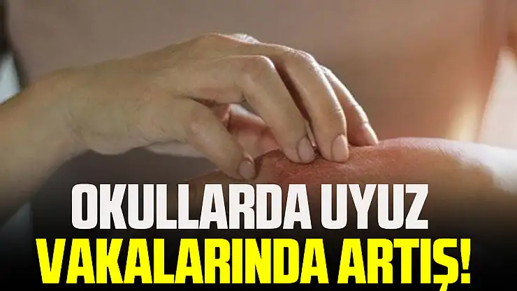Okullarda uyuz vakalarında artış!