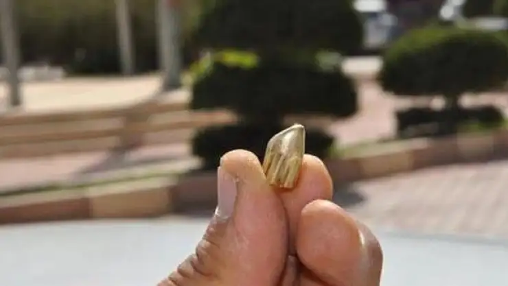 Yorgun mermi isabet etti