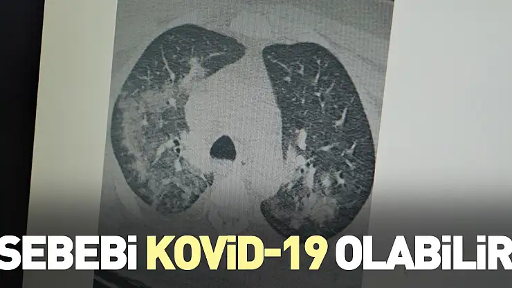 'Sebebi Kovid-19 olabilir'