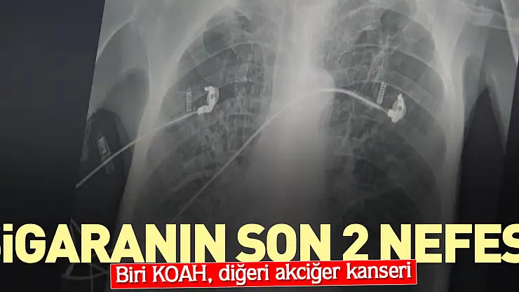 SİGARANIN SON 2 NEFESİ