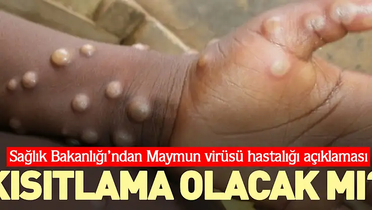 KISITLAMA OLACAK MI?