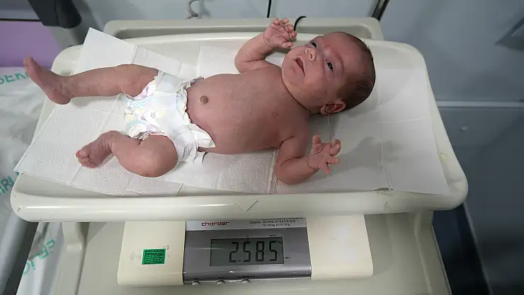 895 gram doğan bebek hayata tutundu