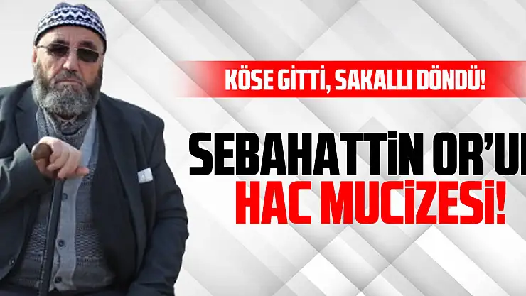 Köse gitti, sakallı döndü!