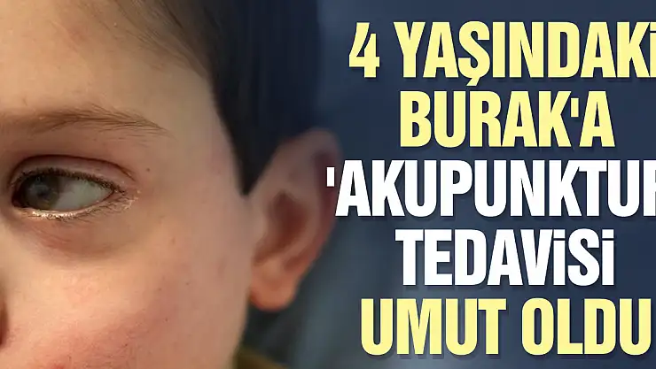 4 yaşındaki Burak'a 'akupunktur' tedavisi umut oldu