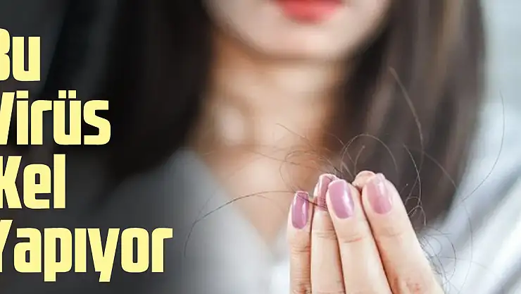 Bu virüs kel yapıyor