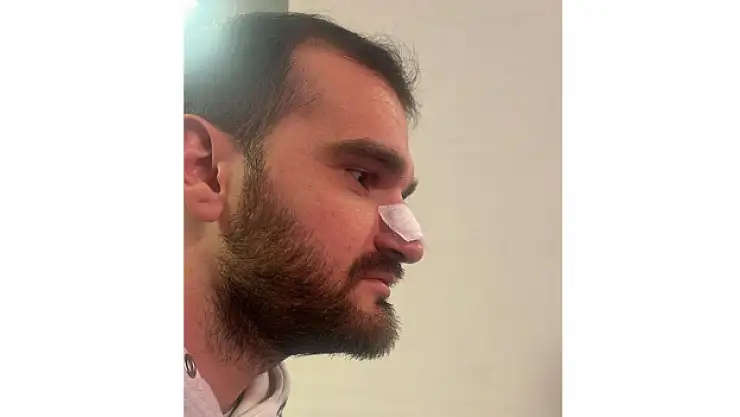 Yeşil saha boks ringine döndü