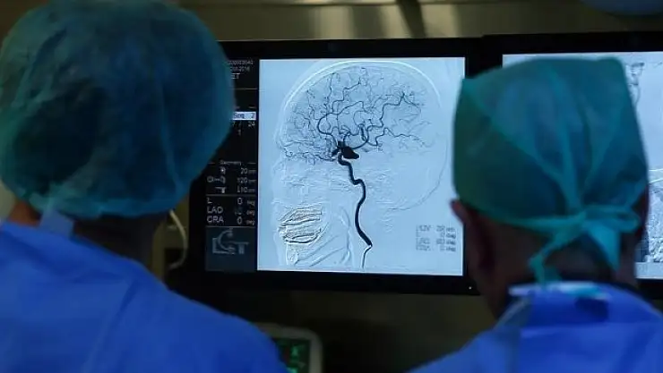 Demansa yakalanma riski daha yüksek