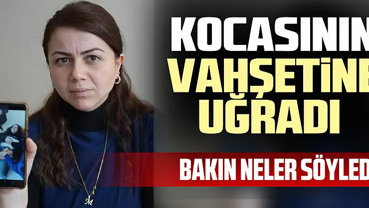 KOCASININ VAHŞETiNE UĞRADI
