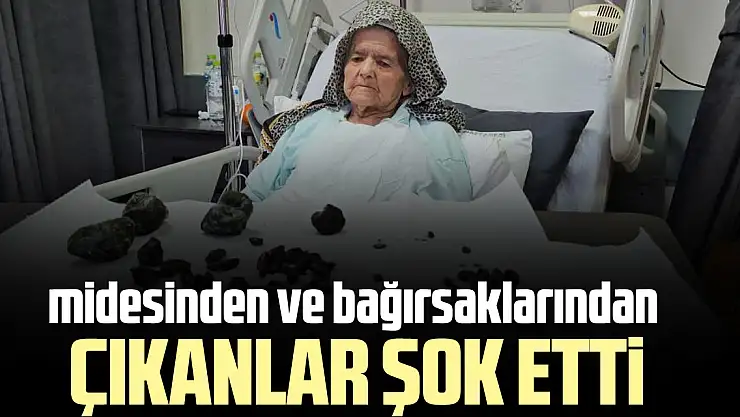 midesinden ve bağırsaklarından çıkanlar şok etti