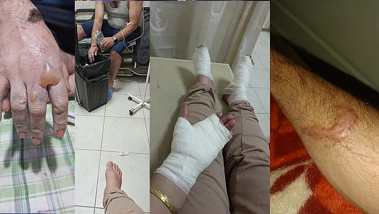 Lavabo açıcı bomba gibi  patladı