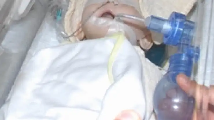 Minik Edanur'un Sağlık Durumu İyiye Gidiyor