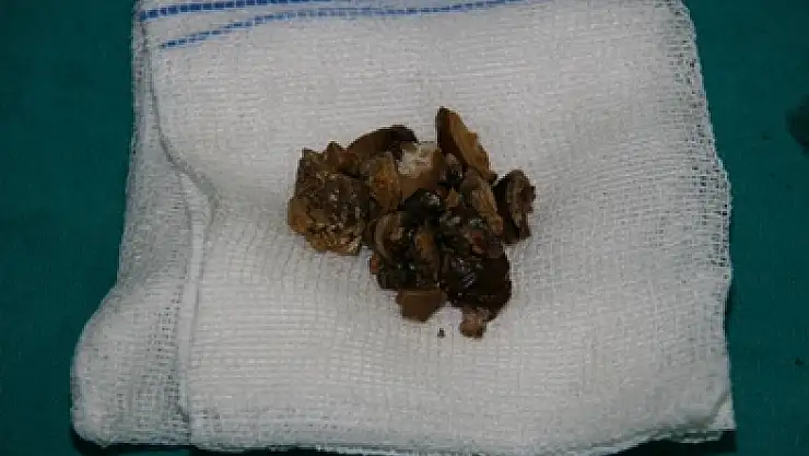 Çarşamba devlet hastanesinde bir ilk