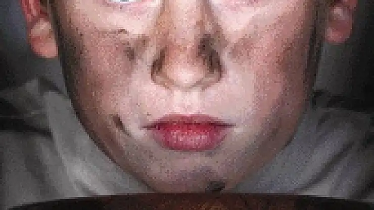 Açlık ve yoksulluk rakamları arttı