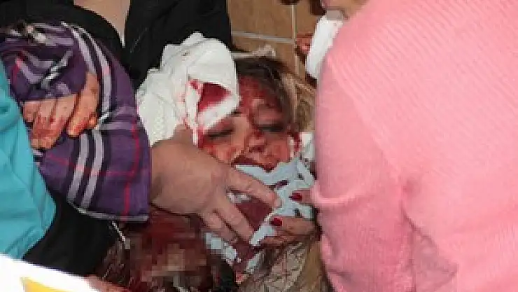 Falçatalı saldırıyı anlattı 