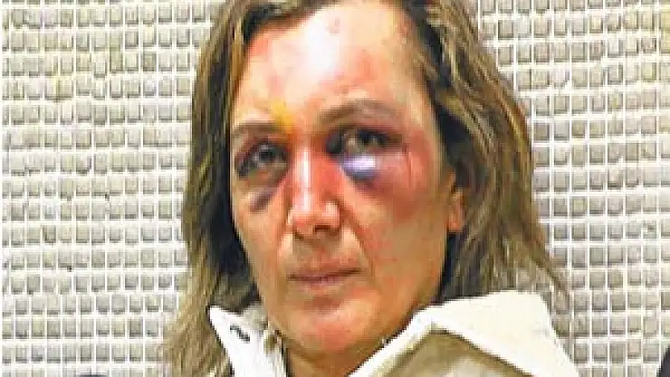 Şiddete Uğrayan Kadın Haklarını Bilmiyor