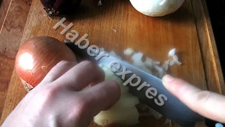 Soğan doğrarken kendini göğsünden yaraladı