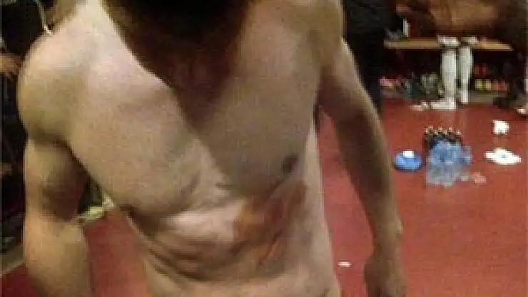 Zokora'nın tekmesi bu hale getirdi