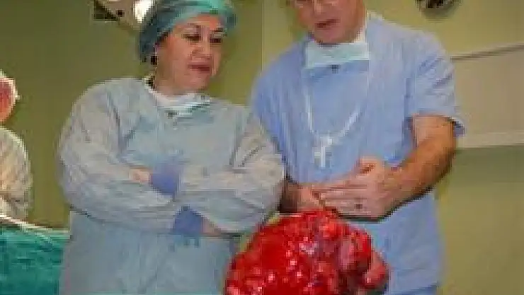 Türkiye'de tespit edilen en büyük rahim myomu