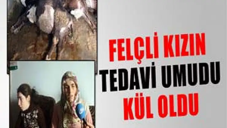 Felçli kızın tedavi umudu kül oldu 