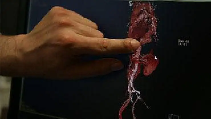 Aynı anda iki ameliyat