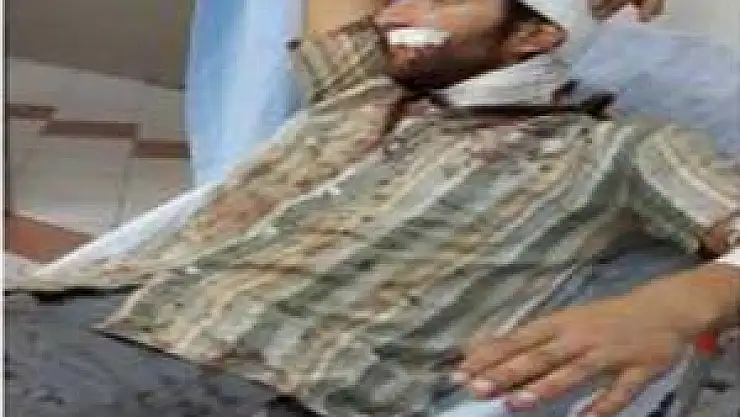 Patpat Devrildi: 4 Yaralı