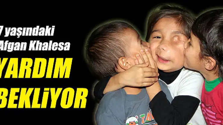 Afganlı Minik Kız Yardım Bekliyor