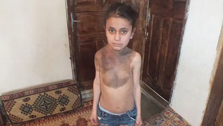 Tedavi olmazsa kolu kesilecek