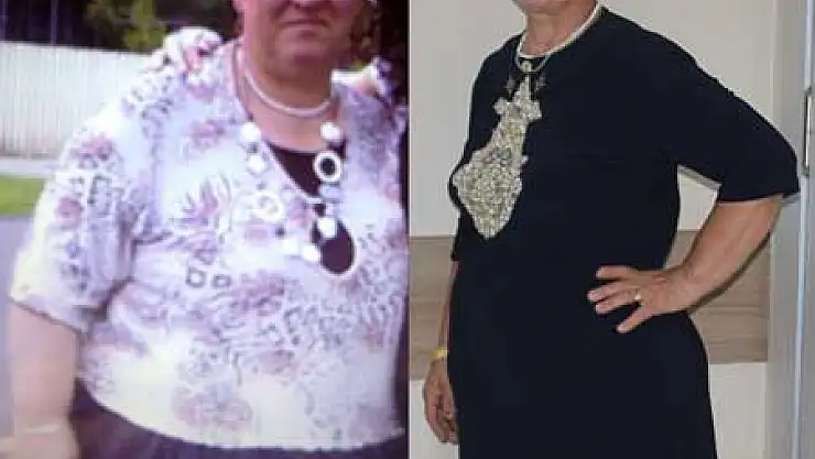 Sağlıklı Beslenerek 50 Kilo Zayıfladı 