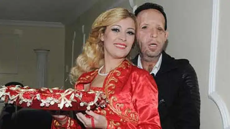 Beşinci yüz nakilli Recep Sert baba oluyor