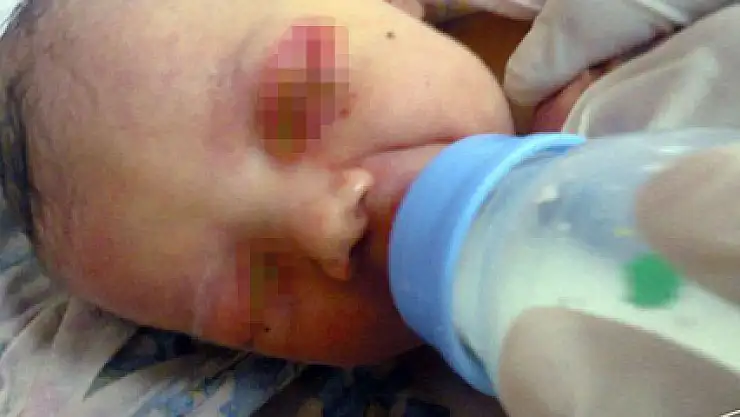 Karıncalar 3 günlük bebeği yedi