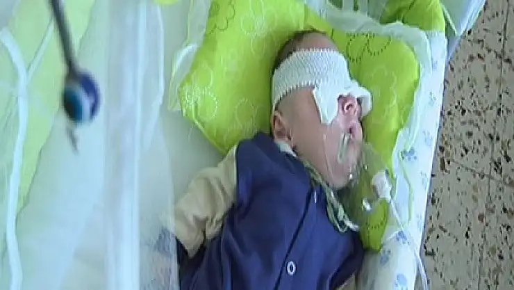 Beyni gözüne inen minik Muhammed yardım bekliyor