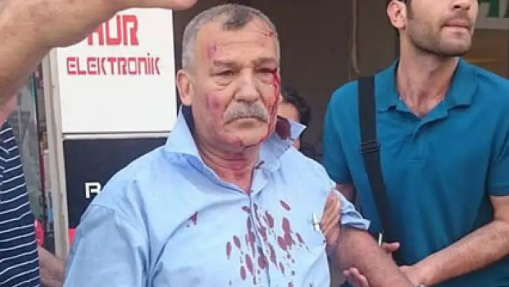 İki bombalı saldırıdan da sağ kurtuldu