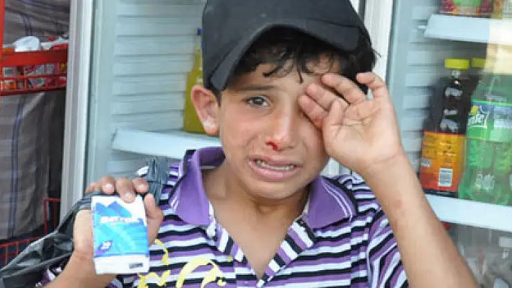 Suriyeli çocuğa darp iddiasındaki esnaf konuştu