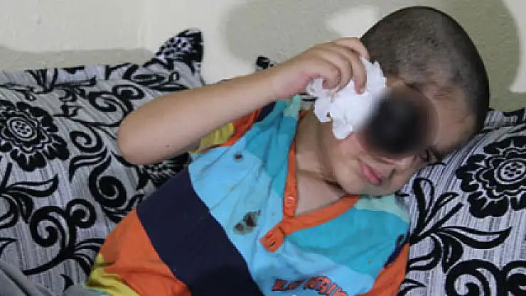 Minik Emir'in gözü, annesinin ise yüreği kan ağlıyor