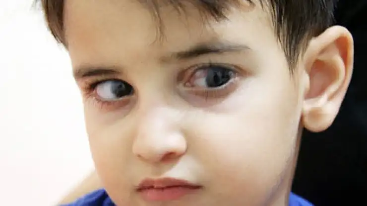 4 yaşında 65'in üzerinde ameliyat geçirdi