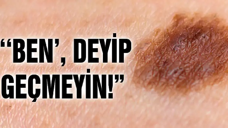 ''BEN', DEYİP GEÇMEYİN!' 