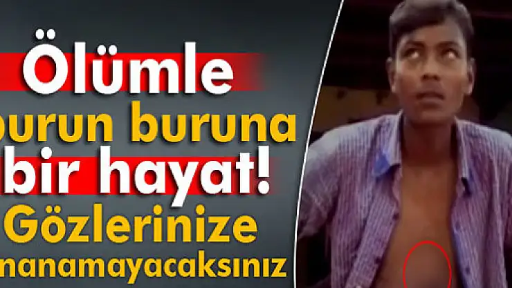 Ölümle burun buruna bir hayat! Kalbi dışarıda atıyor
