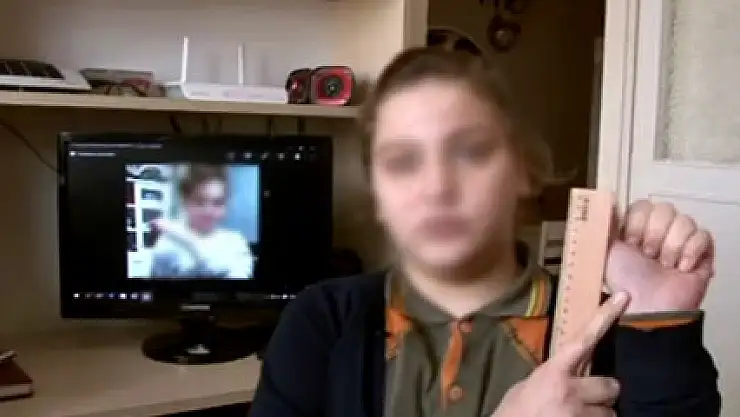 Skandal iddia!Öğretmen öğrencisinin elini cetvelle kırdı!