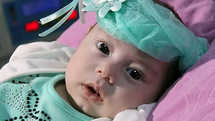 Dört aylık bebek 'doku yapıştırıcısıyla' hayata tutundu