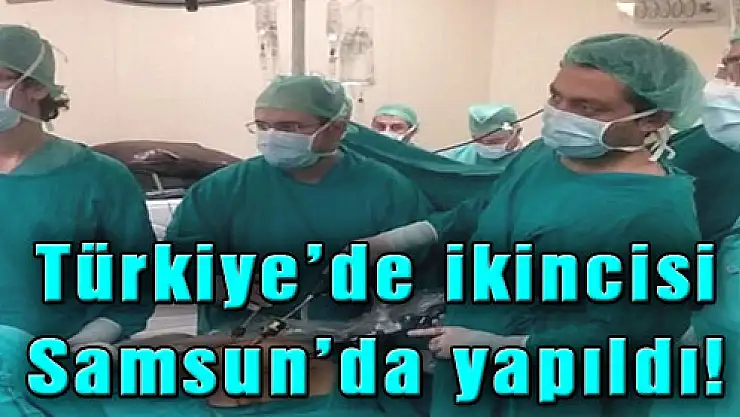 Türkiye'de ikincisi Samsun'da yapıldı!
