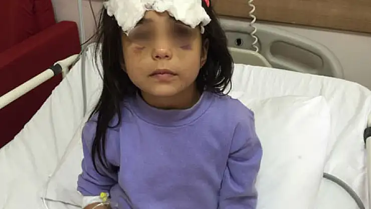 Adana'da üvey anne dehşeti